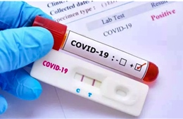 Hà Nội yêu cầu các cơ sở y tế công khai giá dịch vụ xét nghiệm COVID-19
