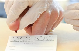 Xét nghiệm máu chích đầu ngón tay có thể phát hiện bệnh trước 10 năm