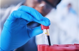 Chỉ cần xét nghiệm máu có thể dự báo sớm bệnh tim di truyền phổ biến nhất thế giới