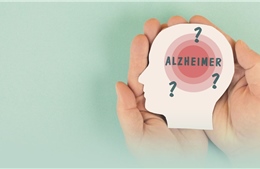 Liệu pháp siêu âm và hy vọng mới trong nghiên cứu Alzheimer