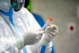 Nga cung cấp 800 bộ thử virus SARS-CoV-2 cho nhiều nước 