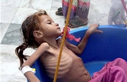Hình ảnh đau thương trẻ em Yemen da bọc xương nhai lá cây để sống