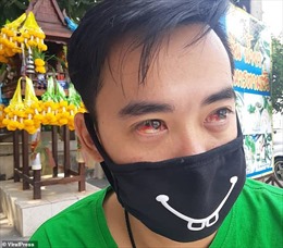 Ô nhiễm không khí cực độc, người dân Thái Lan ho và chảy cả máu mắt