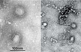 Hình ảnh đầu tiên về virus corona đang hoành hành Trung Quốc qua kính hiển vi 