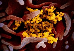 Cận cảnh virus nCoV len lỏi trong tế bào người