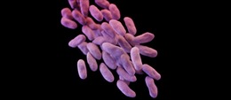 Mỹ cảnh báo tình trạng kháng thuốc kháng sinh gia tăng trong đại dịch