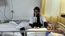 Phát hiện mầm bệnh bí ẩn ở Afghanistan gây sốt cao và chảy máu mũi, hai bệnh nhi đã tử vong 