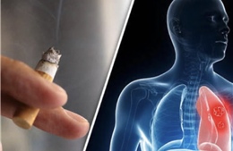 9 ca ung thư phổi đầu tiên từ nghiên cứu mới ở Singapore đều là người không hút thuốc