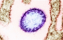 Ấn Độ điều tra dịch tễ và theo dõi nguy cơ liên quan các ca nhiễm virus Nipah  