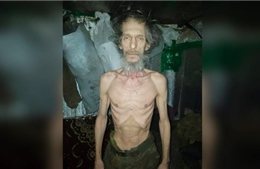 Hình ảnh binh sĩ suy kiệt phơi bày bê bối hậu cần trong quân đội Ukraine