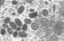 Hai nhà nghiên cứu bị truy tố vì đưa trái phép virus đậu mùa khỉ vào Mỹ