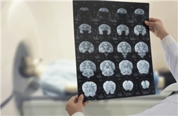 AI mở ra hướng giải mã những bí ẩn y học cho bệnh nhân