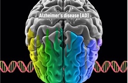 Công bố dữ liệu đầy đủ về thuốc lecanemab điều trị Alzheimer