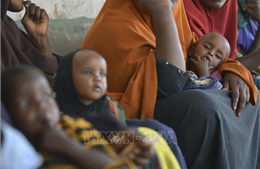 Tình trạng trẻ em suy dinh dưỡng gia tăng ở Somalia