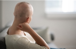 Giải pháp tiềm năng giúp bệnh nhân hóa trị hạn chế rụng tóc