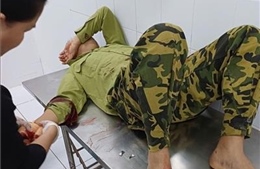 Xử lý nghiêm vụ việc dùng dao chém trọng thương nhân viên bảo vệ rừng