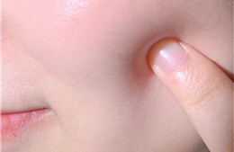 Giải pháp giúp kéo dài tuổi thọ làn da