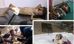Quặn lòng trước cảnh trẻ em Yemen oằn mình trong nạn đói triền miên