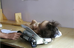 UNICEF kêu gọi giải quyết tình trạng trẻ em suy dinh dưỡng