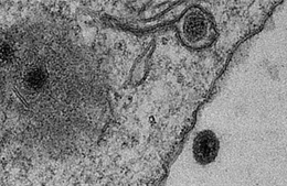 Phát hiện chủng virus mới có nguồn gốc amip 