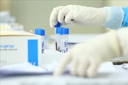 Dịch COVID-19: Viện Pasteur Nha Trang tạm hoãn nhận mẫu xét nghiệm