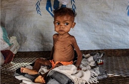 Cảnh báo về tình trạng trẻ em suy dinh dưỡng nghiêm trọng tại khu vực Sahel 
