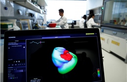 Phương pháp phân tích hình ảnh chụp CT mới giúp cảnh báo sớm bệnh đau tim