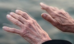 Các nhà khoa học Bỉ giải mã thành công bệnh Parkinson