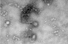 Nhật Bản xác nhận trường hợp đầu tiên nhiễm chủng virus corona mới từ Trung Quốc