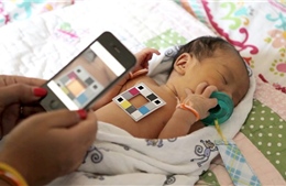 Ứng dụng điện thoại thông minh giúp chẩn đoán bệnh vàng da ở trẻ sơ sinh