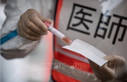 Nhật Bản sắp có hệ thống robot xét nghiệm PCR tự động