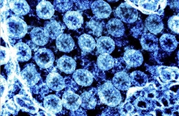 Giới chuyên gia Nhật Bản cảnh báo hệ số lây nhiễm của biến thể Omicron cao gấp 4,2 lần Delta