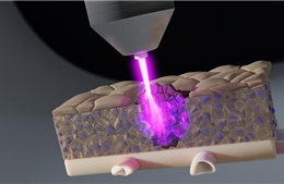 Tia plasma lạnh tiêu diệt tế bào ung thư ẩn sâu