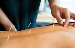 Nghiên cứu Mỹ khẳng định châm cứu hiệu quả với chứng đau lưng mạn tính
