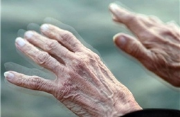 Lần đầu quan sát được &#39;mồi lửa&#39; khởi phát bệnh Parkinson