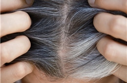 Mối liên quan giữa tóc bạc và nguy cơ ung thư