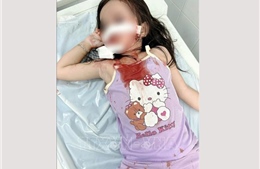 Bé gái 4 tuổi bị chó thả rông tấn công, thương tích nghiêm trọng vùng mặt