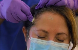 AI dự đoán chính xác hàng chục vấn đề sức khỏe thông qua giấc ngủ