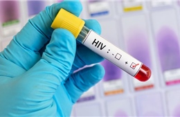 Mang nhầm &#39;án&#39; HIV gần 10 năm mà không hay biết