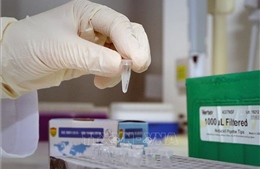 Xét nghiệm lần đầu, 172 chuyên gia Hàn Quốc tại Bắc Ninh âm tính với virus SARS-CoV-2