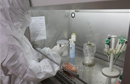 Trung tâm Kiểm soát bệnh tật tỉnh Yên Bái được xét nghiệm khẳng định mắc COVID-19