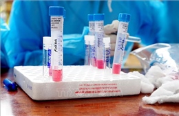 Gia Lai: Các trường hợp tiếp xúc với bệnh nhân COVID-19 tại Đà Nẵng có kết quả xét nghiệm âm tính