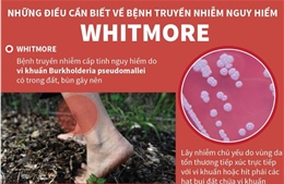 Những điều cần biết về bệnh truyền nhiễm nguy hiểm Whitmore