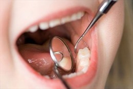 Hy hữu răng sữa rơi vào phổi khi tự nhổ răng tại nhà