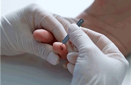 Phát hiện sớm bệnh Alzheimer từ lấy máu đầu ngón tay