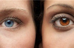 Ca phẫu thuật đổi màu mắt đầu tiên tại Nam Phi