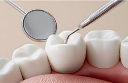 Xử phạt, đình chỉ hoạt động 5 cơ sở nha khoa không phép