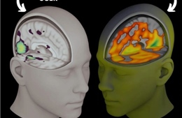 Cảnh báo tình trạng suy giảm nhận thức do lạm dụng trí tuệ nhân tạo