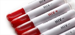 Gần 40% số ca nhiễm HIV mới tại Mỹ không biết mình bị nhiễm