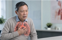 Chuyên gia y tế cảnh báo 'gánh nặng kép' về mô hình bệnh tật